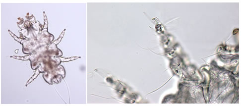 Rat Fur Mite