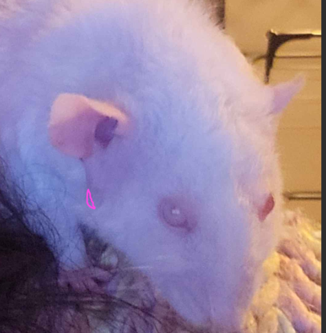 ZGT Tumour Abscess