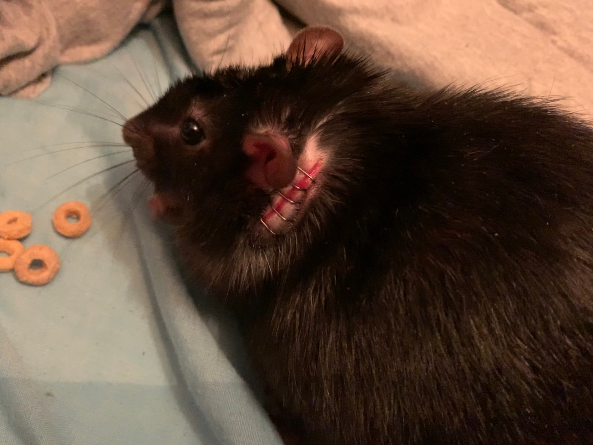 Severe rat bite requiring staples