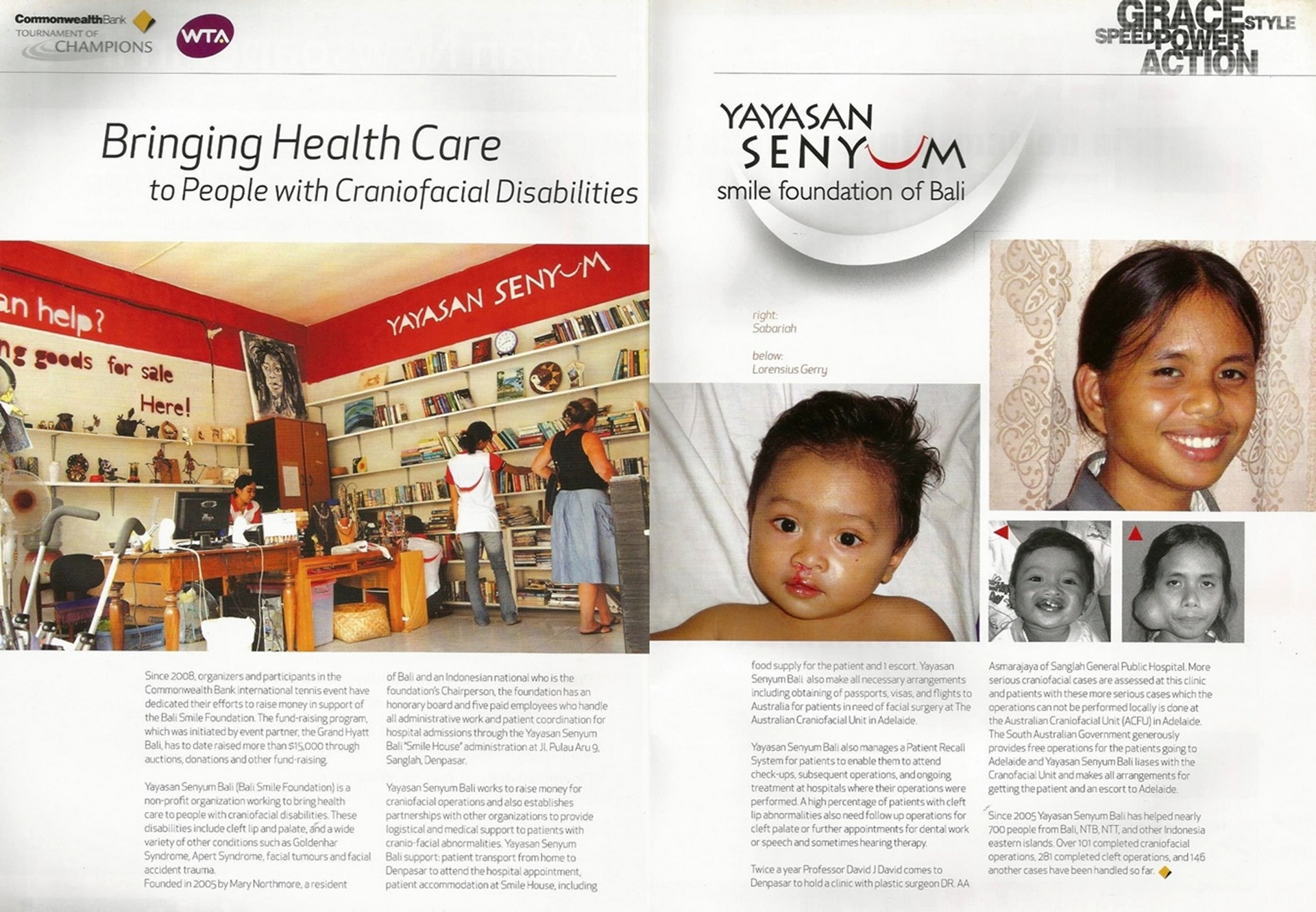 Bringing Health Care to People with Craniofacial Disabilities - Yayasan Senyum  smile foundation of Bali
