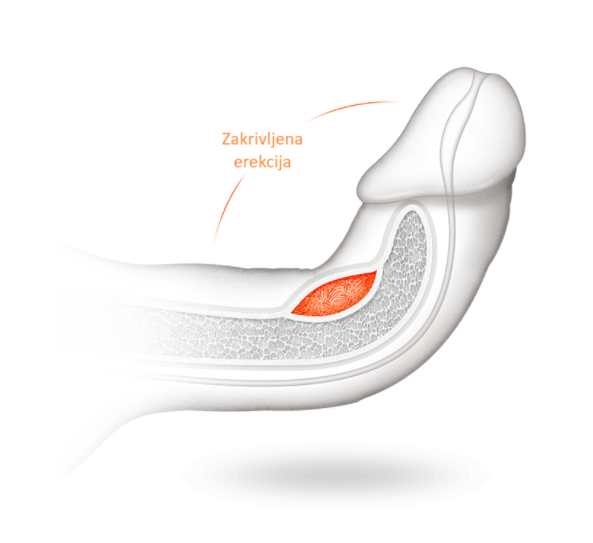 Profizikal easy flossing
