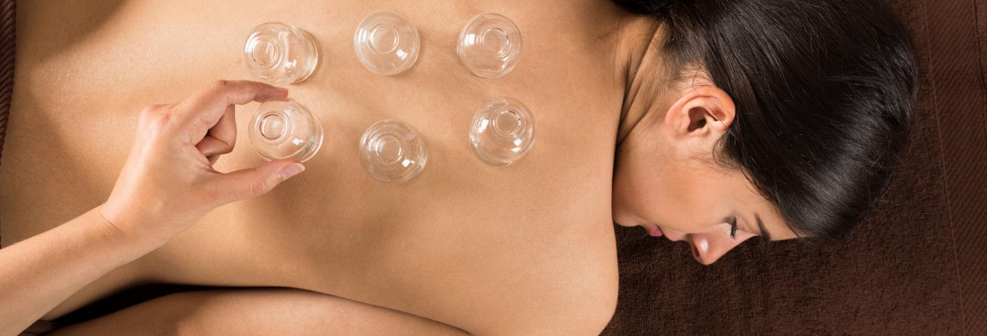 Cupping Profizikal Beograd
