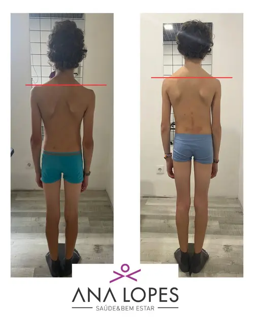 fisioterapia especializada