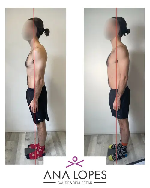 fisioterapia especializada