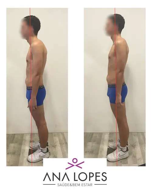 fisioterapia especializada