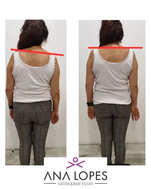 fisioterapia especializada