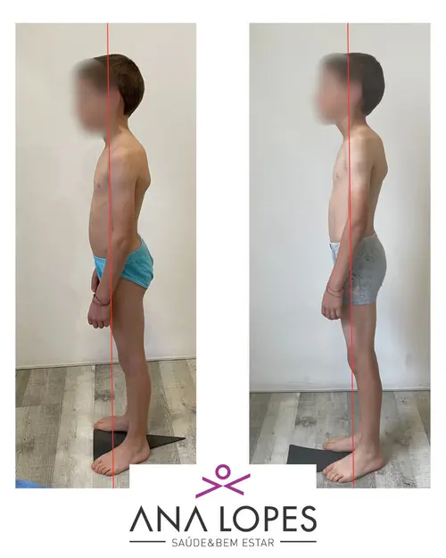 fisioterapia especializada