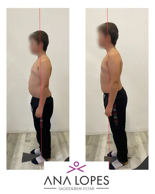 fisioterapia especializada