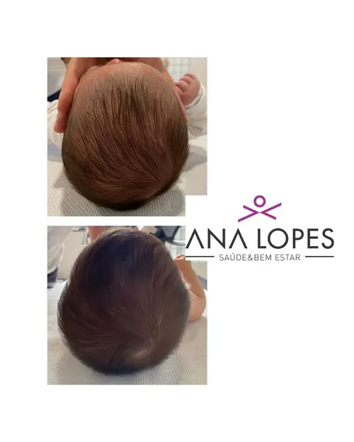 fisioterapia especializada