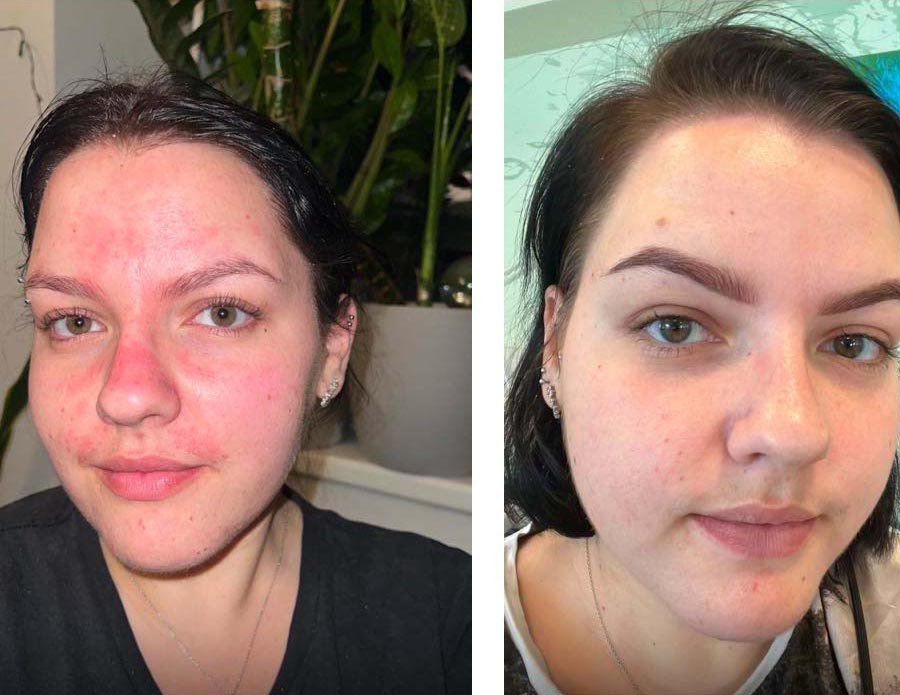 Before/After