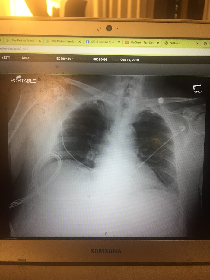 Dad got sepsis and was in hospital