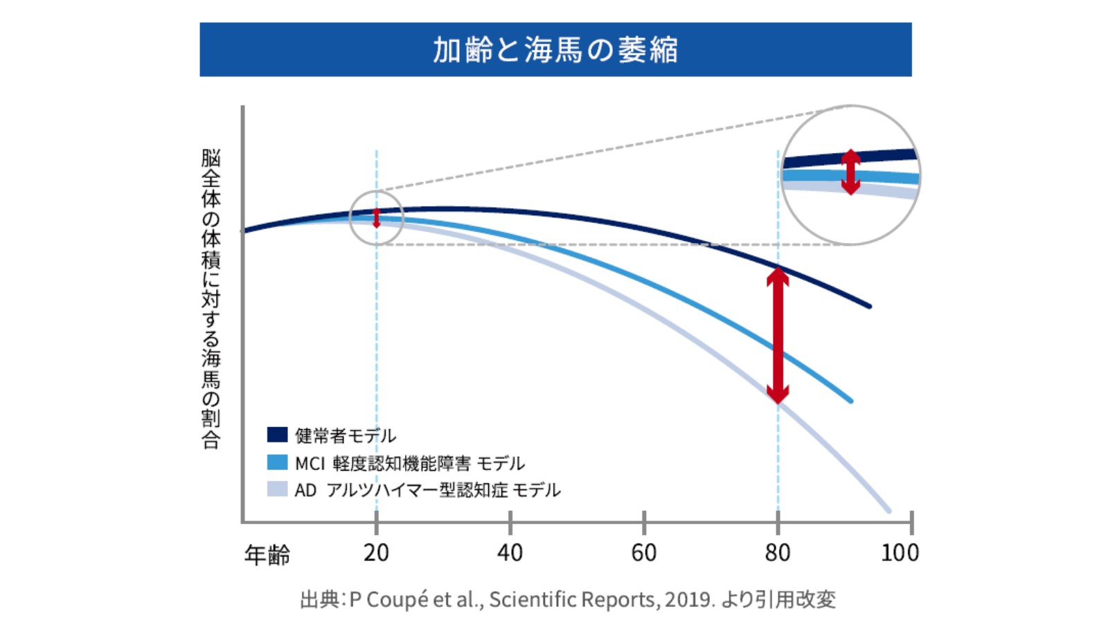 加齢と海馬の萎縮