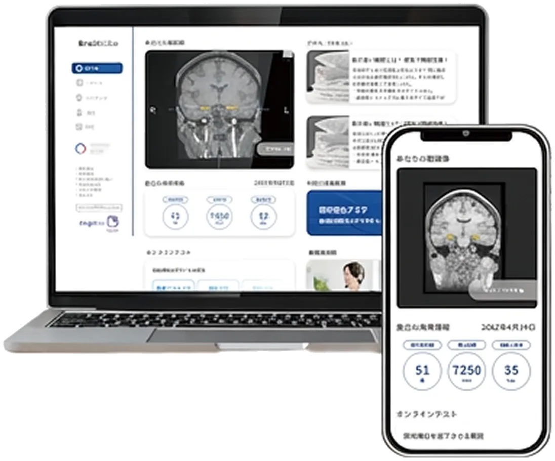 MyBrainの画面（PC・スマートフォン）