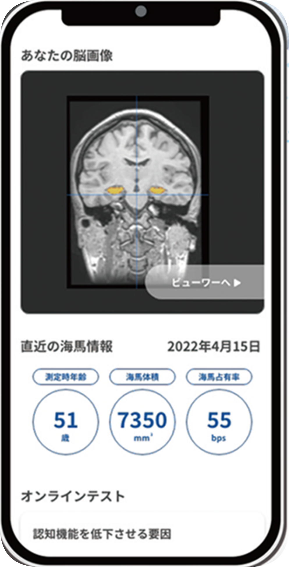 MyBrainマイページをスマートフォンで見る
